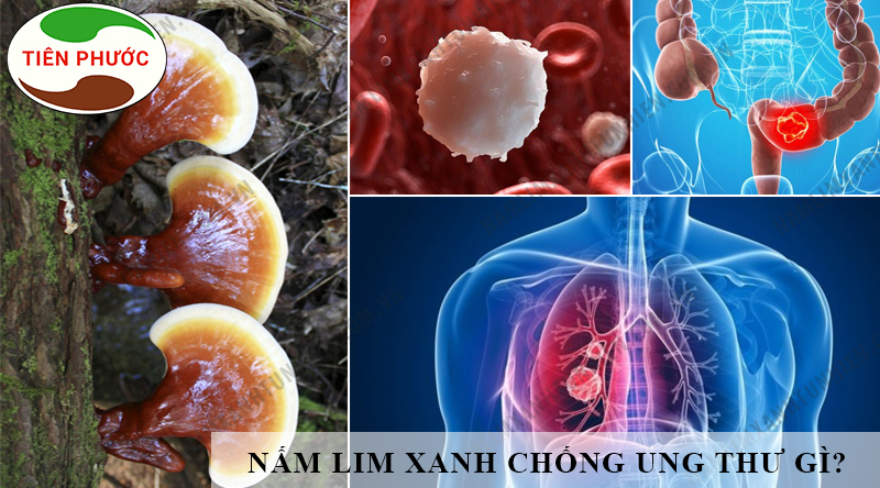 Nấm Lim Xanh Chống Ung Thư Gì? Lý Do Nấm Lim Xanh Chống Ung Thư?